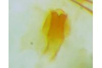Cochylis flaviciliana