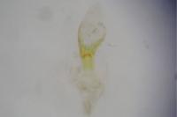 Aethes bilbaensis