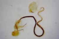 Coleophora