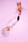 Coleophora binderella