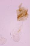 Parornix torquillella