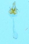 Paraswammerdamia nebulella