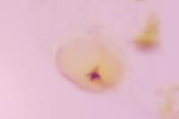 Phyllonorycter oxyacanthae