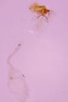 Parornix devoniella