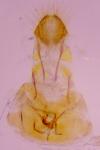 Phyllonorycter belotella