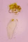 Parornix betulae