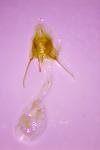Epischnia asteris