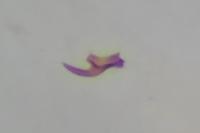 Scrobipalpa ocellatella