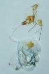 Endothenia quadrimaculana