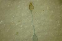 Parornix finitimella