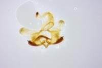 Coleophora albicosta