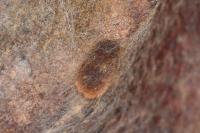 Stigmella obliquella