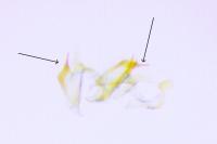 Coleophora glaucicolella