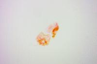 Stigmella suberivora