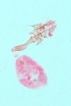 Acleris sparsana