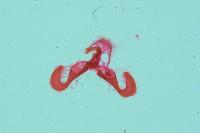 Dichrorampha alpinana