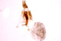Dichrorampha senectana