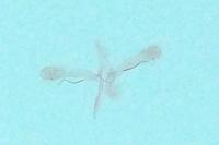 Phyllonorycter maestingella