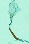 Stenoptilia annadactyla