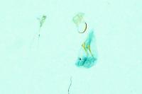 Stenoptilia annadactyla