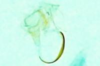 Stenoptilia annadactyla