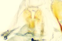 Tinea pellionella